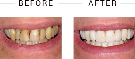 Dentist in Columbia City